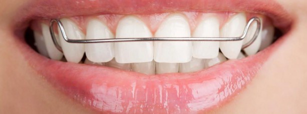 Пластинки на зубы